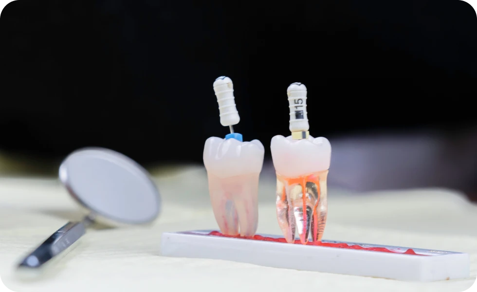 Endodontie